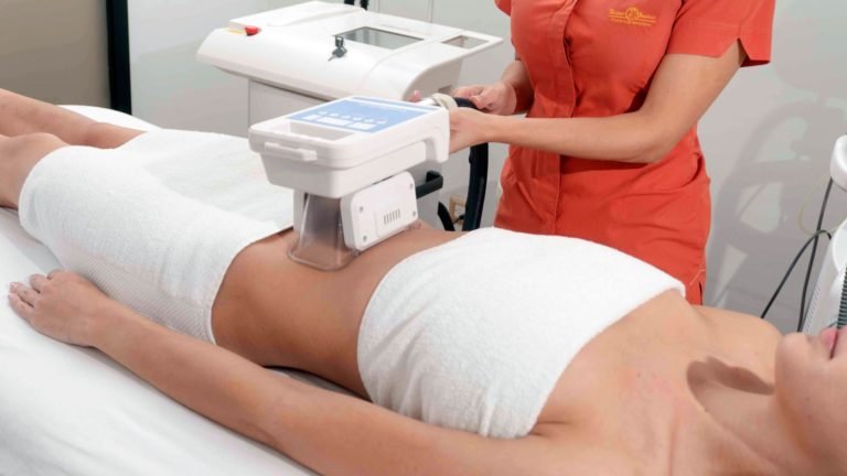 Criolipólisis, la liposucción sin cirugía